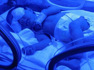 Baby with Birth Injury Image