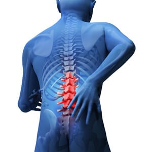 spinal cord injury illustration