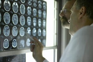 traumatic brain injury lawyer and lawsuits