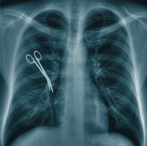medical malpractice x-ray