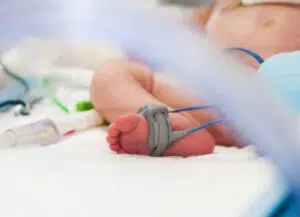 Baby with NEC in hospital care